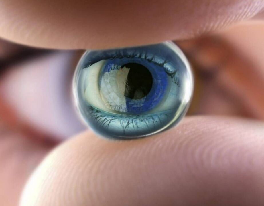 Orthokatologische Nachtlinsen stoppen den Fortschritt der Sehbehinderung